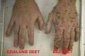 FORESTA DEET 30% MOCNY NA KOMARY KLESZCZE www.rob-tar.pl